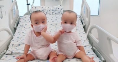 Trúc Nhi – Diệu Nhi tháo nẹp, chuẩn bị tập đi những bước đầu đời